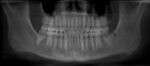 dental implants honolulu